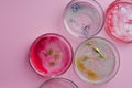 Growth of different bacterial cultures, concept. Bacteriological examination.