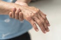 Guillain-Barre Syndrome GBS, Peripheral Neuropathy pain in elderly patient on hand, fingers, sensory nerves with numb Royalty Free Stock Photo