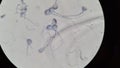 Guinea pig spermatozoa under microscope Royalty Free Stock Photo