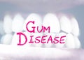 Gum disease medical term with blur infected teeth background