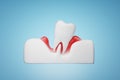 gums disease gingival recession on blue background