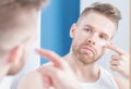 Guy applying facial cream Royalty Free Stock Photo