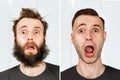 Guy with beard and without hair loss. Man before and after shave or transplant. haircut set transformation Royalty Free Stock Photo