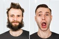 Guy with beard and without hair loss. Man before and after shave or transplant. haircut set transformation Royalty Free Stock Photo