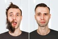 Guy with beard and without hair loss. Man before and after shave or transplant. haircut set transformation Royalty Free Stock Photo