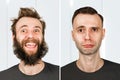 Guy with beard and without hair loss. Man before and after shave or transplant. haircut set transformation Royalty Free Stock Photo