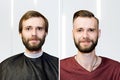 Guy before after haircut Concept for a barber shop: the problem man of hair loss, alopecia, transplantation Royalty Free Stock Photo