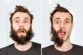 Guy with half beard and without hair loss. Man before and after shave or transplant. haircut set transformation Royalty Free Stock Photo