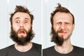 Guy with half beard and without hair loss. Man before and after shave or transplant. haircut set transformation Royalty Free Stock Photo