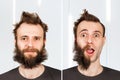 Guy with half beard and without hair loss. Man before and after shave or transplant. haircut set transformation Royalty Free Stock Photo