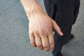 Guy`s injured hand. Swollen hand.