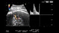 Gynecological echography medical examination. 33 weeks old pregnancy with estimated size of the fetus check, high definition