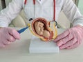 Gynecologist doctor holds scalpel and abortion anatomy of fetus of child