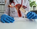 Gynecologist holding female genital organ and contraceptives