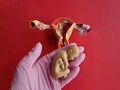 Gynecologist holds in hand model of artificial baby fetus and uterus