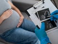 Gynecologist looks at an ultrasound of a pregnant woman. Royalty Free Stock Photo