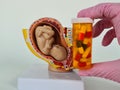 Gynecologist recommends medication pills for baby embryo