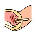 Gynecology ultrasound color line illustration