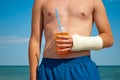 Gypsum fracture on a man`s hand, cocktail juice orange, sand close-up against the background of the sea and the sky