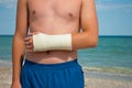 Gypsum fracture on a man`s hand, sand close-up against the background of the sea and the sky clouds, broken arm limb