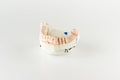 Gypsum model of artificial teeth Royalty Free Stock Photo