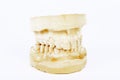 Gypsum model for denture isolated