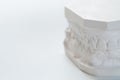 Gypsum model of human jaw on a white background. Royalty Free Stock Photo
