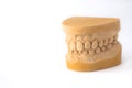 Gypsum model plaster of tooth