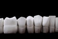 gypsum teeth model