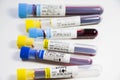 H1N1, Covid-19, Hepatitis C, Tuberculosis and Staphylococcus viruses blood tests in the tubes, laboratory diagnostics