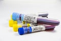 H1N1, Covid-19, Hepatitis C, Tuberculosis and Staphylococcus viruses blood tests in the tubes, laboratory diagnostics