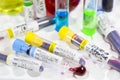 H1N1, Covid-19, Hepatitis C, Tuberculosis and Staphylococcus viruses blood tests in the tubes, laboratory diagnostics