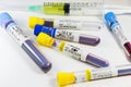 H1N1, Covid-19, Hepatitis C, Tuberculosis and Staphylococcus viruses blood tests in the tubes, laboratory diagnostics