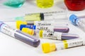 H1N1, Covid-19, Hepatitis C, Tuberculosis and Staphylococcus viruses blood tests in the tubes, laboratory diagnostics