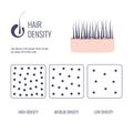 Hair density types chart of low, medium, high strand volume