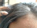 Hair detail with dandruff that sticks, ideal for anti dandruff shampoo advertising