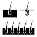 Hair Follicle Icons Set. Vector Royalty Free Stock Photo