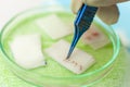 Hair follicles in the Cup close-up. Baldness treatment. Hair transplant. Surgeons in the operating room carry out hair Royalty Free Stock Photo