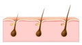 Hair growth. Cross section of a human skin with Hair follicles