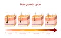 Hair growth cycle Royalty Free Stock Photo