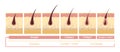 Hair growth cycle illustration. Anatomical diagram of development hair follicles from anagen telagen.