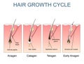 Hair growth cycle labelled illustration Royalty Free Stock Photo