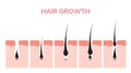 Hair growth cycle skin. Follicle anatomy anagen phase, hair growth diagram illustration Royalty Free Stock Photo