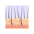 Scheme of the structure of the hair root in the skin layer color vector illustration.