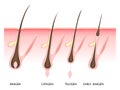 Hair growth phase, vector illustration