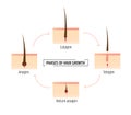 Hair growth phases. Infographics trichology and dermatology. Laser Hair Removal