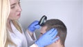 A trichologist examines the hair of a man who begins alopecia. Consultation with a dermatologist. Hair loss, alopecia, pruritus, b