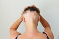 Hair loss in the form of alopecia areata. Royalty Free Stock Photo