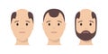 Hair loss man icon cartoon vector logo. Hair loss male scalp bald illustration