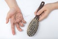 Hair loss problem Royalty Free Stock Photo